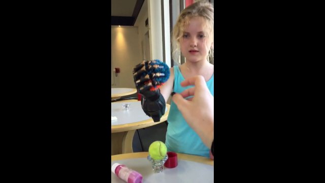 Bionic Hand is a Reality [VIDEO]