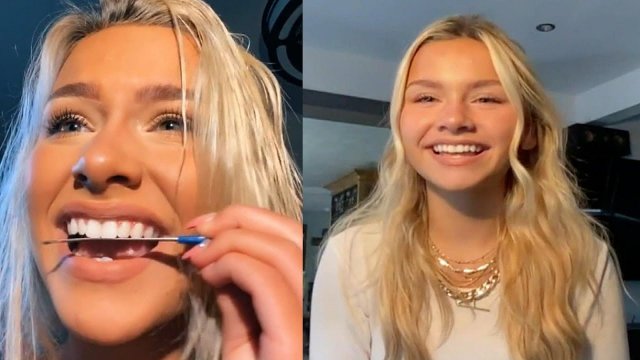 Why This 19-Year-Old TikToker Used a Nail File on Her Teeth